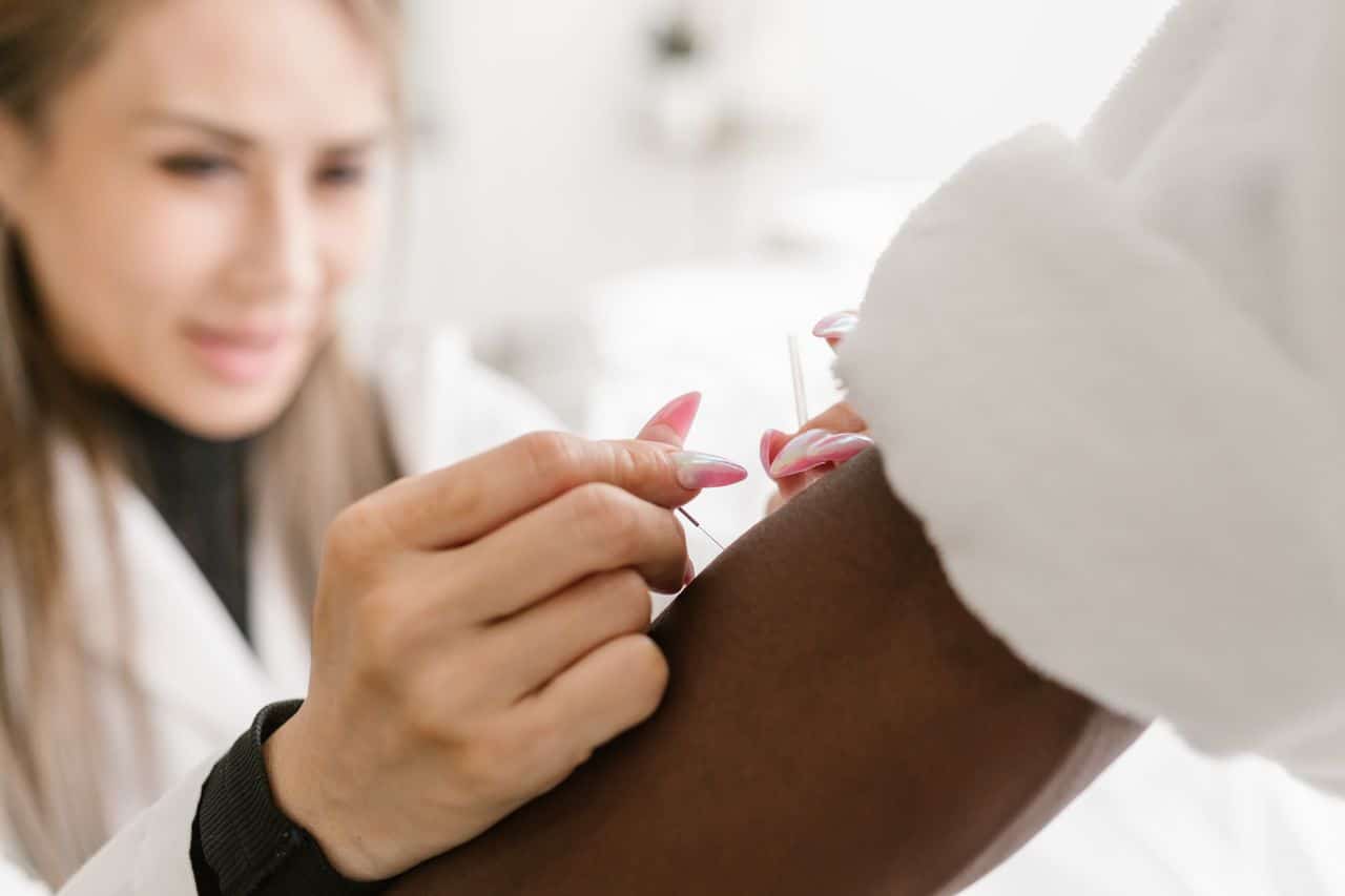 Close-up of a therapist performing acupuncture on a client's arm